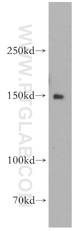 Western Blot (WB) analysis of HT-1080 cells using DHX29 Polyclonal antibody (13923-1-AP)