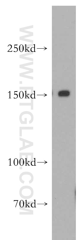 Western Blot (WB) analysis of MCF-7 cells using DHX29 Polyclonal antibody (13923-1-AP)