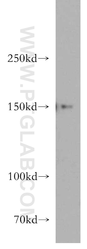 Western Blot (WB) analysis of HepG2 cells using DHX29 Polyclonal antibody (13923-1-AP)