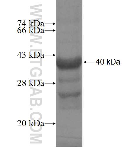 DHX29 fusion protein Ag4938 SDS-PAGE