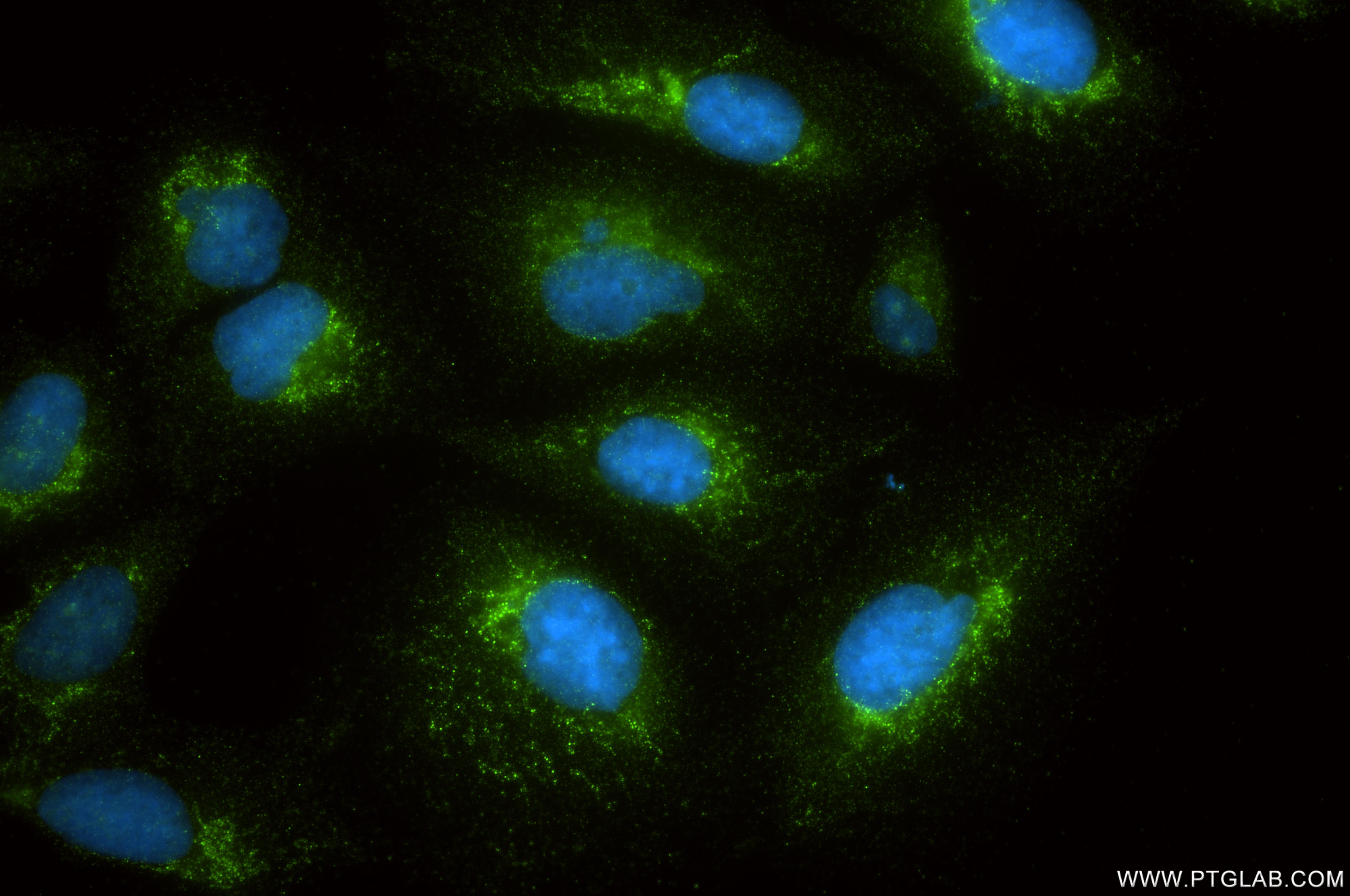 Immunofluorescence (IF) / fluorescent staining of U2OS cells using DHX30 Recombinant monoclonal antibody (87317-1-RR)