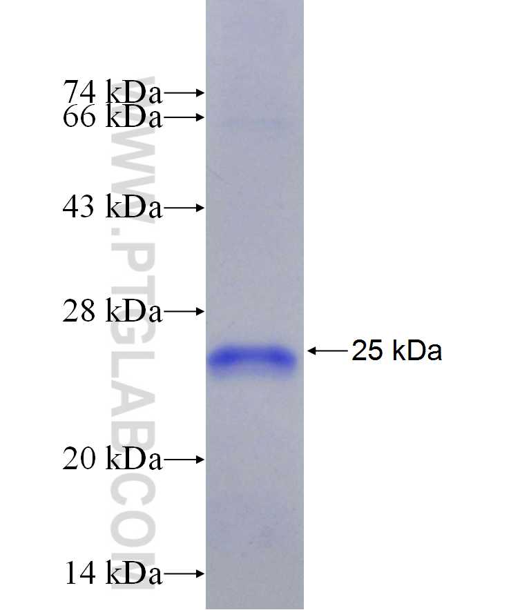 DHX30 fusion protein Ag29885 SDS-PAGE