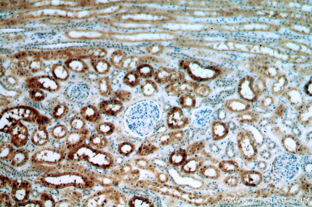 Immunohistochemistry (IHC) staining of human kidney tissue using DHX32 Polyclonal antibody (19808-1-AP)