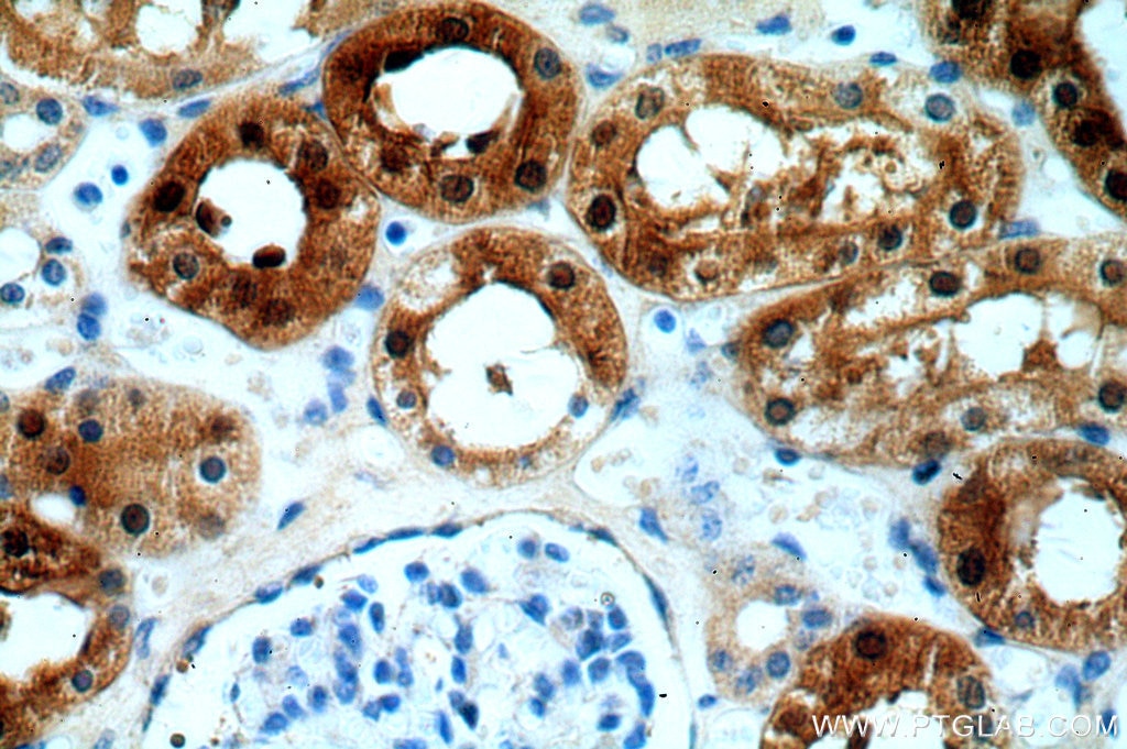 Immunohistochemistry (IHC) staining of human kidney tissue using DHX32 Polyclonal antibody (19808-1-AP)