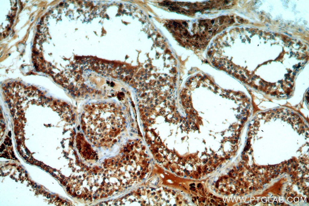 Immunohistochemistry (IHC) staining of human testis tissue using DHX32 Polyclonal antibody (19808-1-AP)