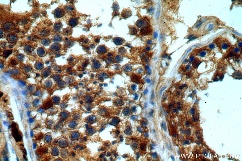 Immunohistochemistry (IHC) staining of human testis tissue using DHX32 Polyclonal antibody (19808-1-AP)