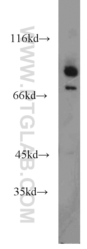 Western Blot (WB) analysis of mouse kidney tissue using DHX32 Polyclonal antibody (19808-1-AP)