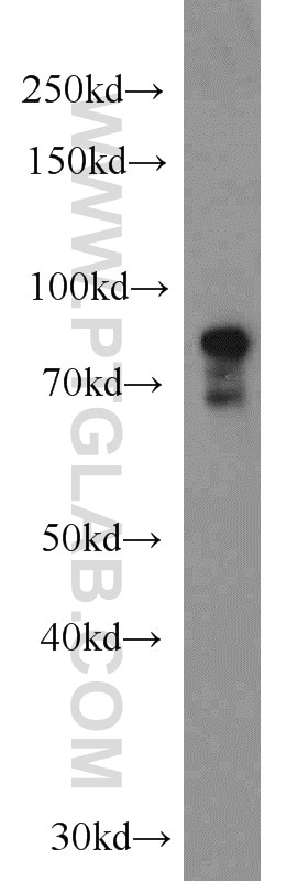 Western Blot (WB) analysis of mouse colon tissue using DHX32 Polyclonal antibody (19808-1-AP)