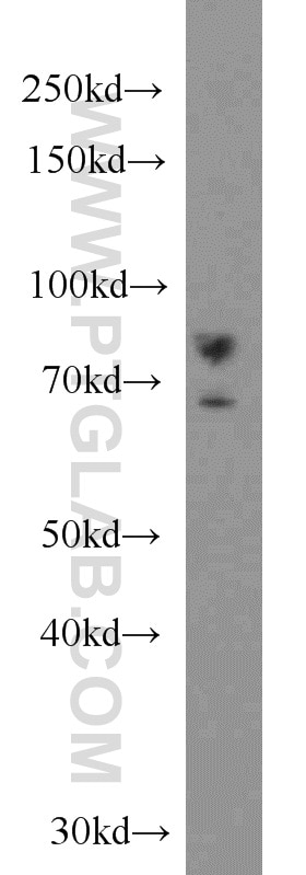 Western Blot (WB) analysis of A431 cells using DHX32 Polyclonal antibody (19808-1-AP)