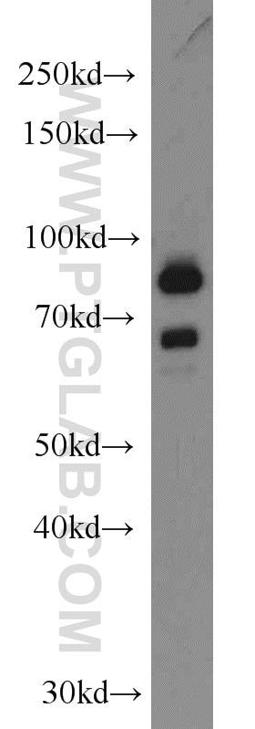 Western Blot (WB) analysis of COLO 320 cells using DHX32 Polyclonal antibody (19808-1-AP)