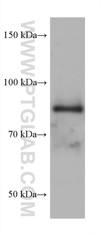 Western Blot (WB) analysis of U2OS cells using DHX32 Monoclonal antibody (68306-1-Ig)