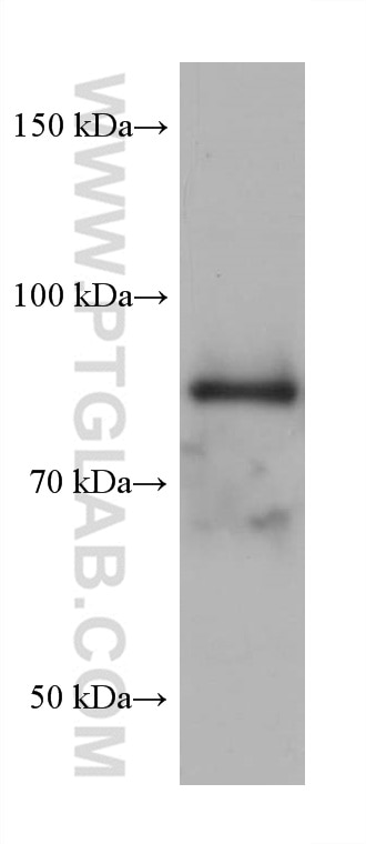 WB analysis of U2OS using 68306-1-Ig