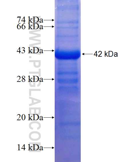 DHX32 fusion protein Ag13956 SDS-PAGE