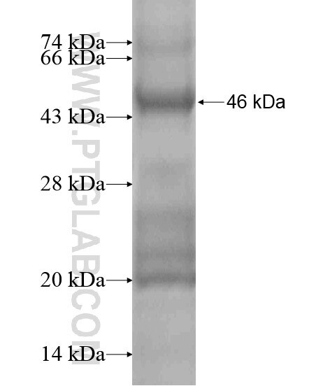 DHX35 fusion protein Ag20693 SDS-PAGE