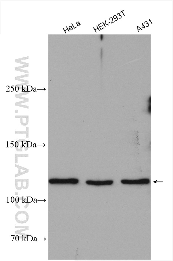 Western Blot (WB) analysis of various lysates using DHX36 Polyclonal antibody (13159-1-AP)