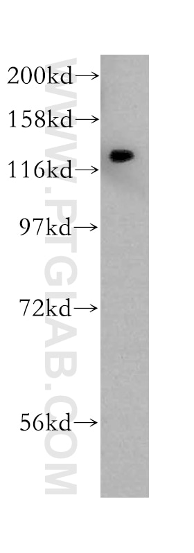 Western Blot (WB) analysis of human brain tissue using DHX36 Polyclonal antibody (13159-1-AP)