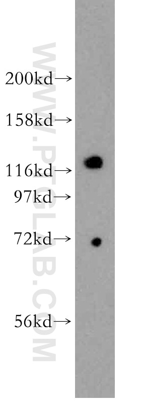 Western Blot (WB) analysis of PC-3 cells using DHX36 Polyclonal antibody (13159-1-AP)