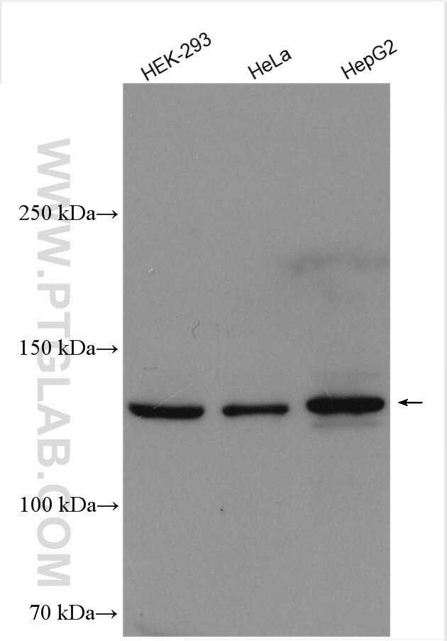 WB analysis using 29741-1-AP