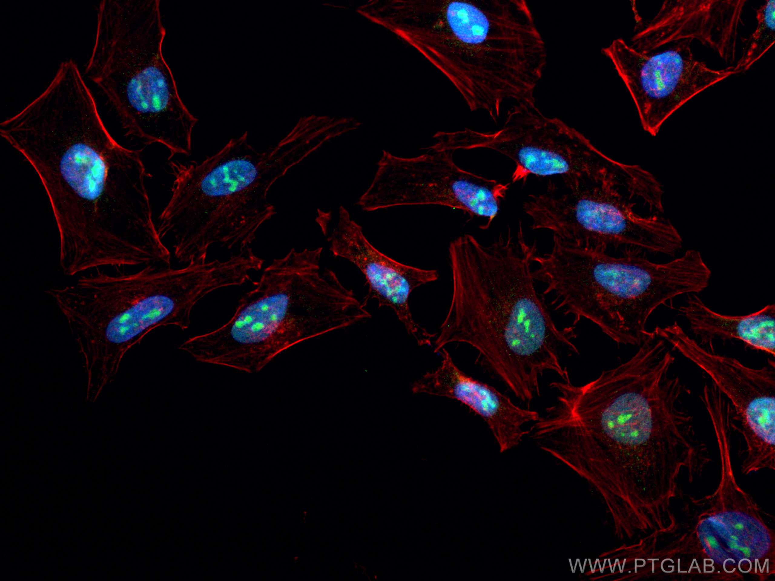 Immunofluorescence (IF) / fluorescent staining of HeLa cells using DHX37 Monoclonal antibody (67853-1-Ig)