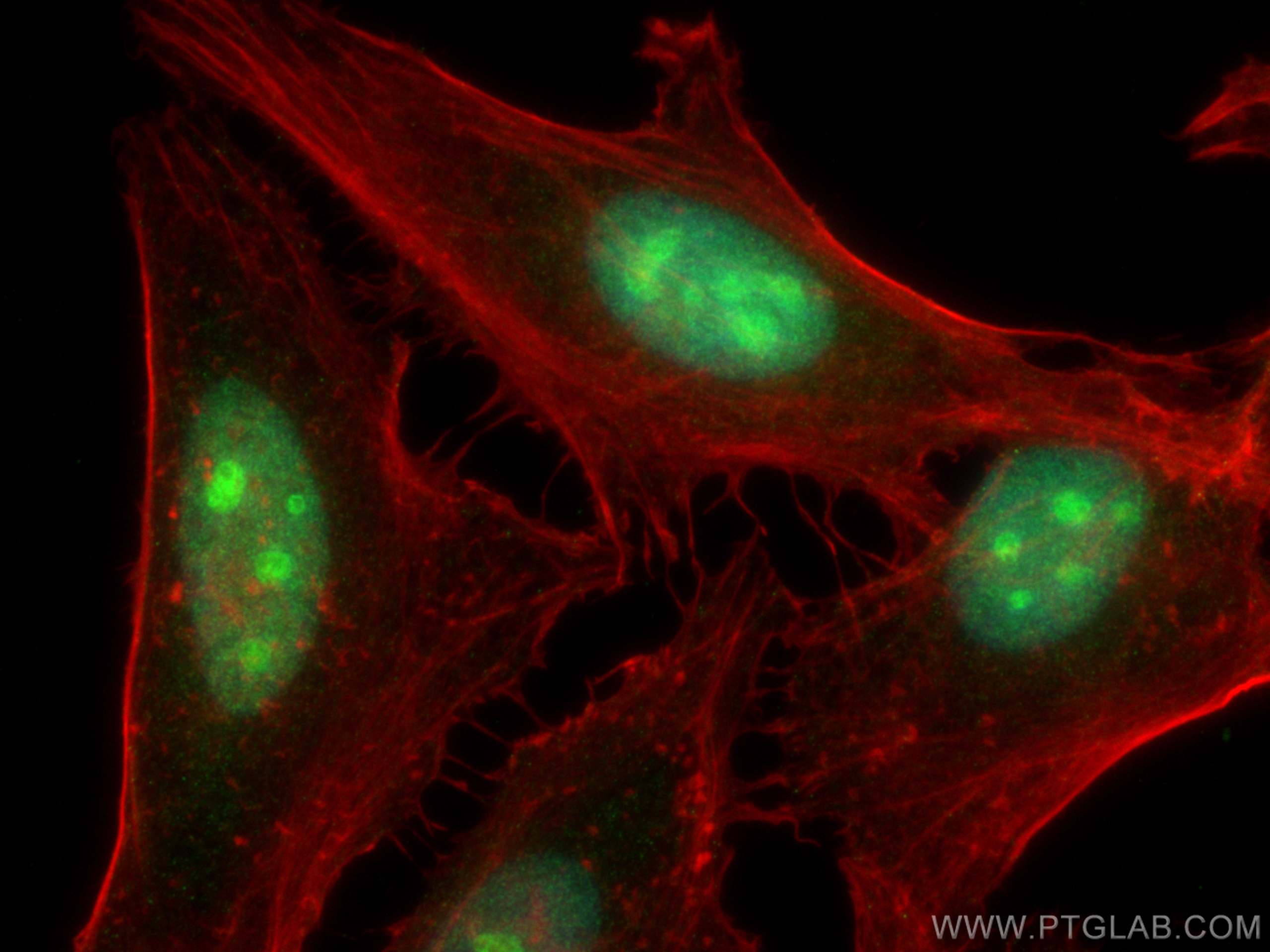 Immunofluorescence (IF) / fluorescent staining of HeLa cells using DHX37 Monoclonal antibody (67853-1-Ig)