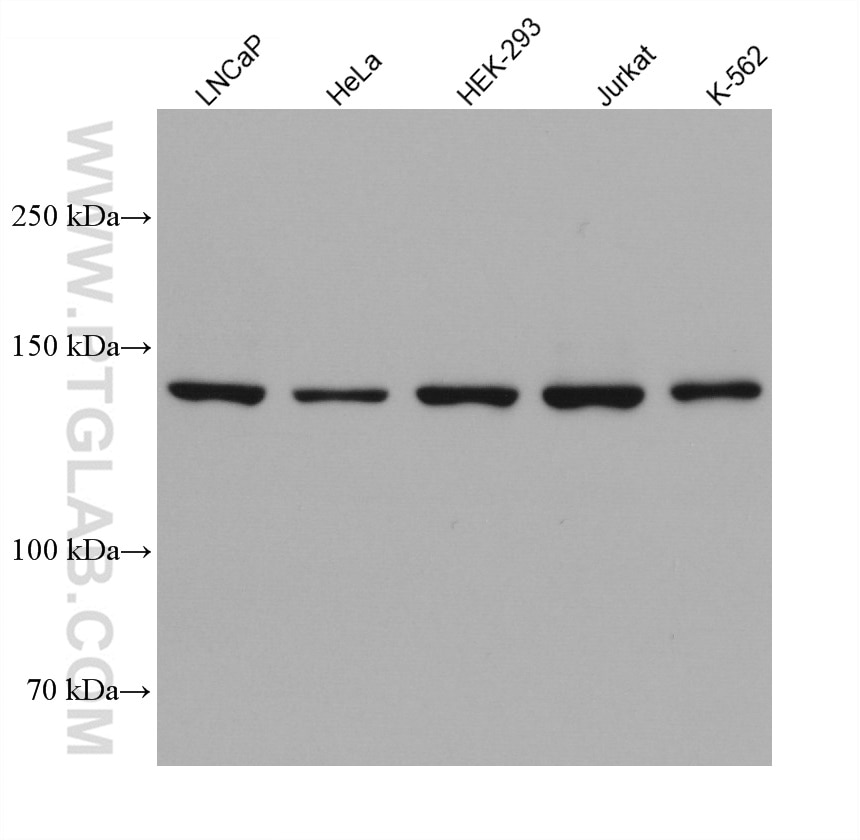 WB analysis using 67853-1-Ig