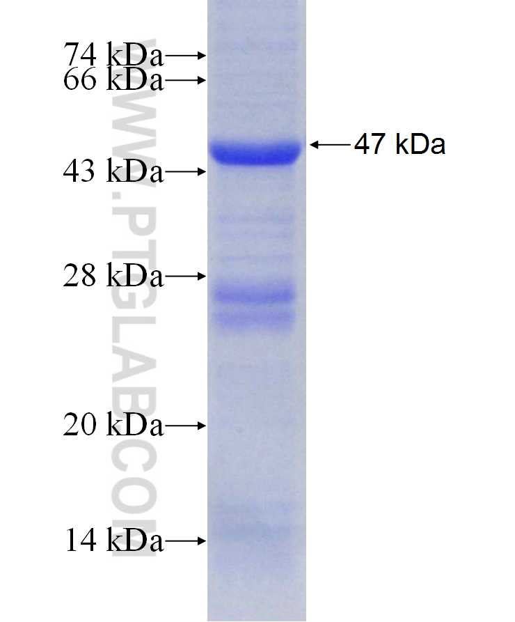 DHX37 fusion protein Ag29909 SDS-PAGE