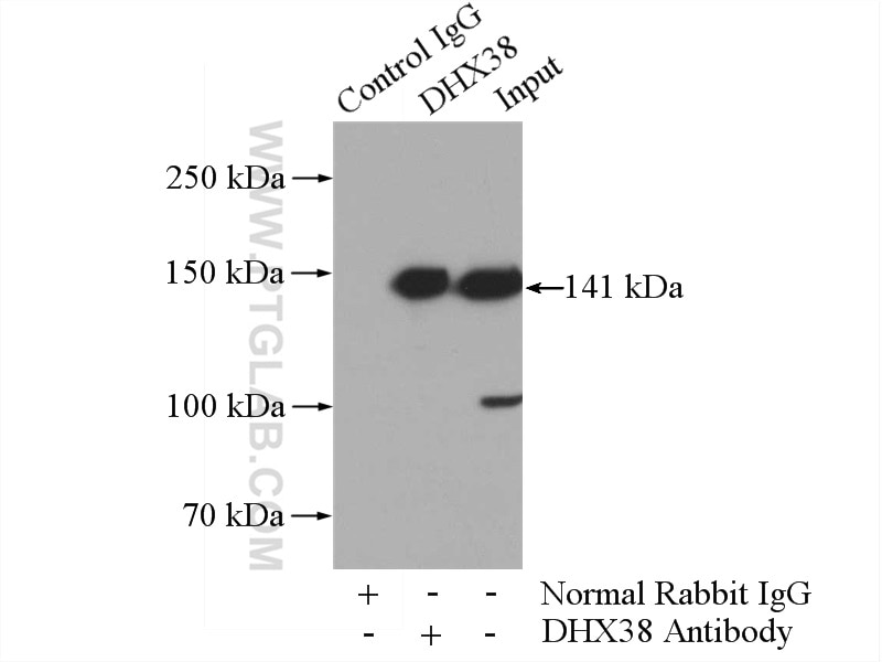Immunoprecipitation (IP) experiment of HeLa cells using DHX38 Polyclonal antibody (10098-2-AP)