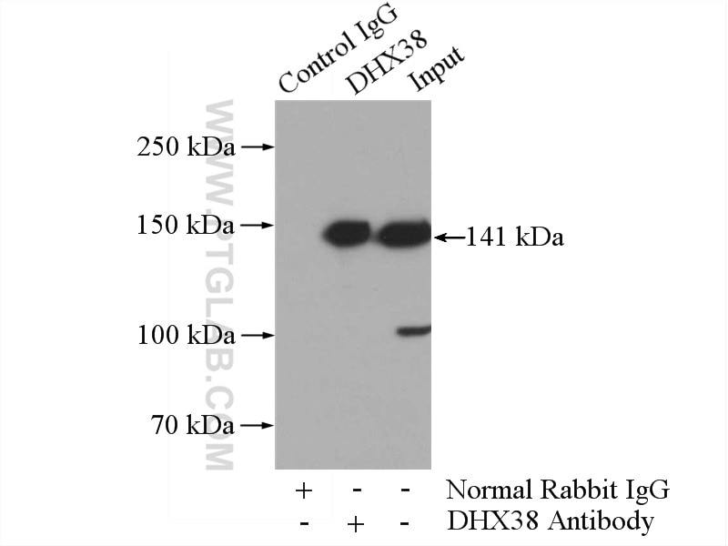 IP experiment of HeLa using 10098-2-AP