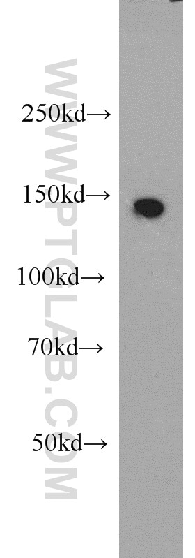 Western Blot (WB) analysis of HEK-293 cells using DHX38 Polyclonal antibody (10098-2-AP)
