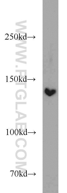 Western Blot (WB) analysis of HepG2 cells using DHX38 Polyclonal antibody (10098-2-AP)