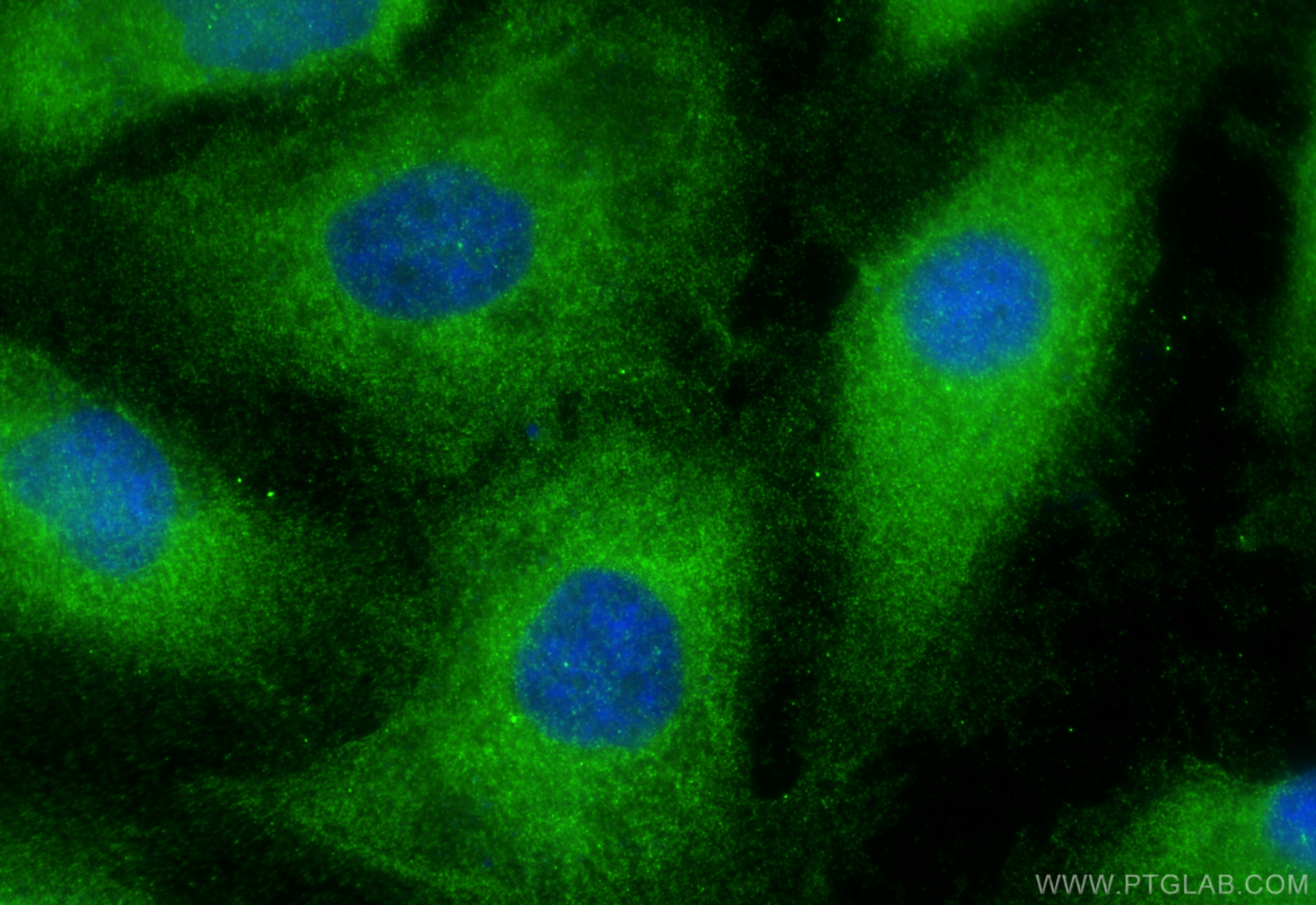 Immunofluorescence (IF) / fluorescent staining of HeLa cells using DHX57 Polyclonal antibody (24525-1-AP)