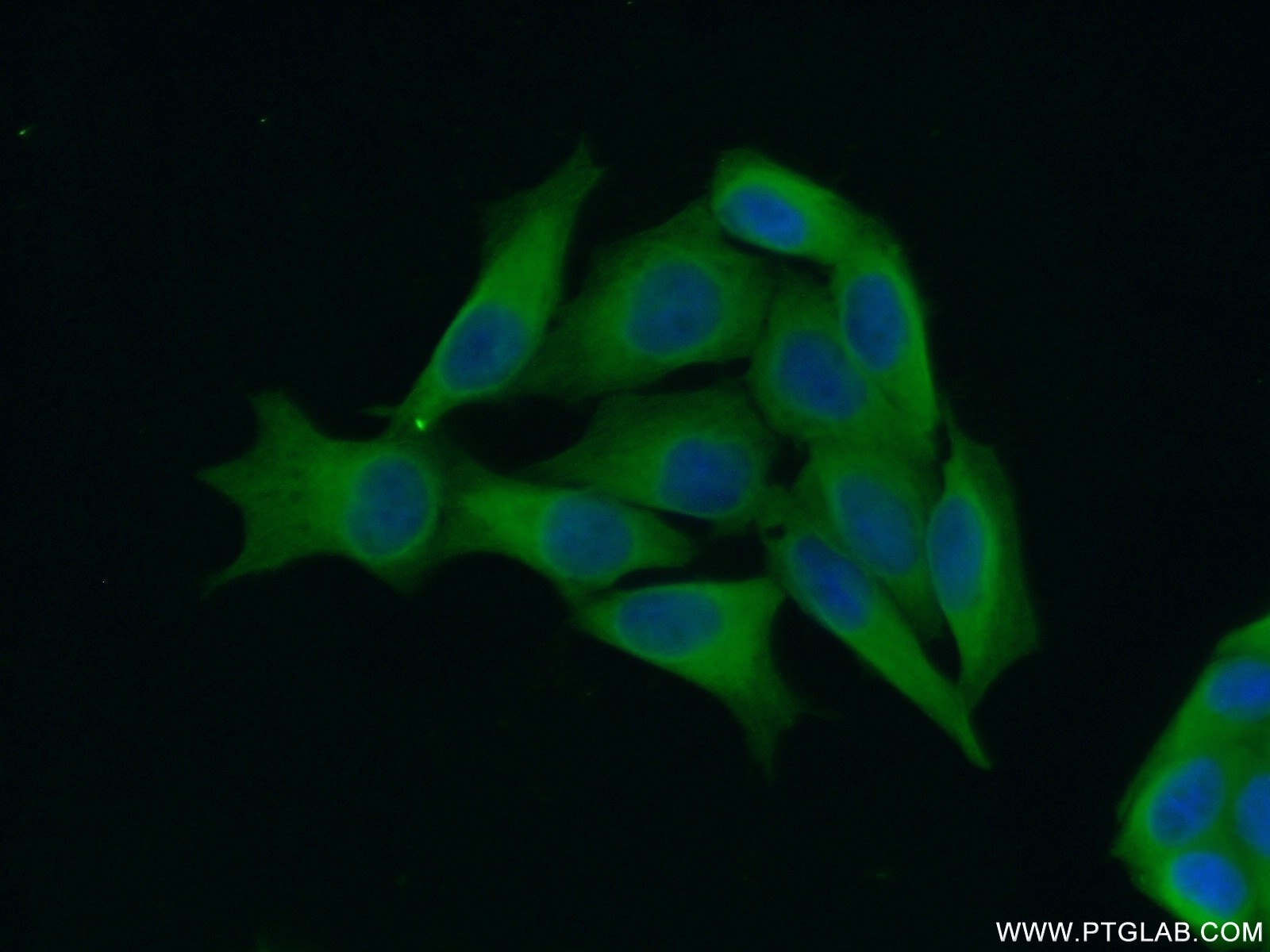 Immunofluorescence (IF) / fluorescent staining of HeLa cells using DHX57 Polyclonal antibody (24525-1-AP)