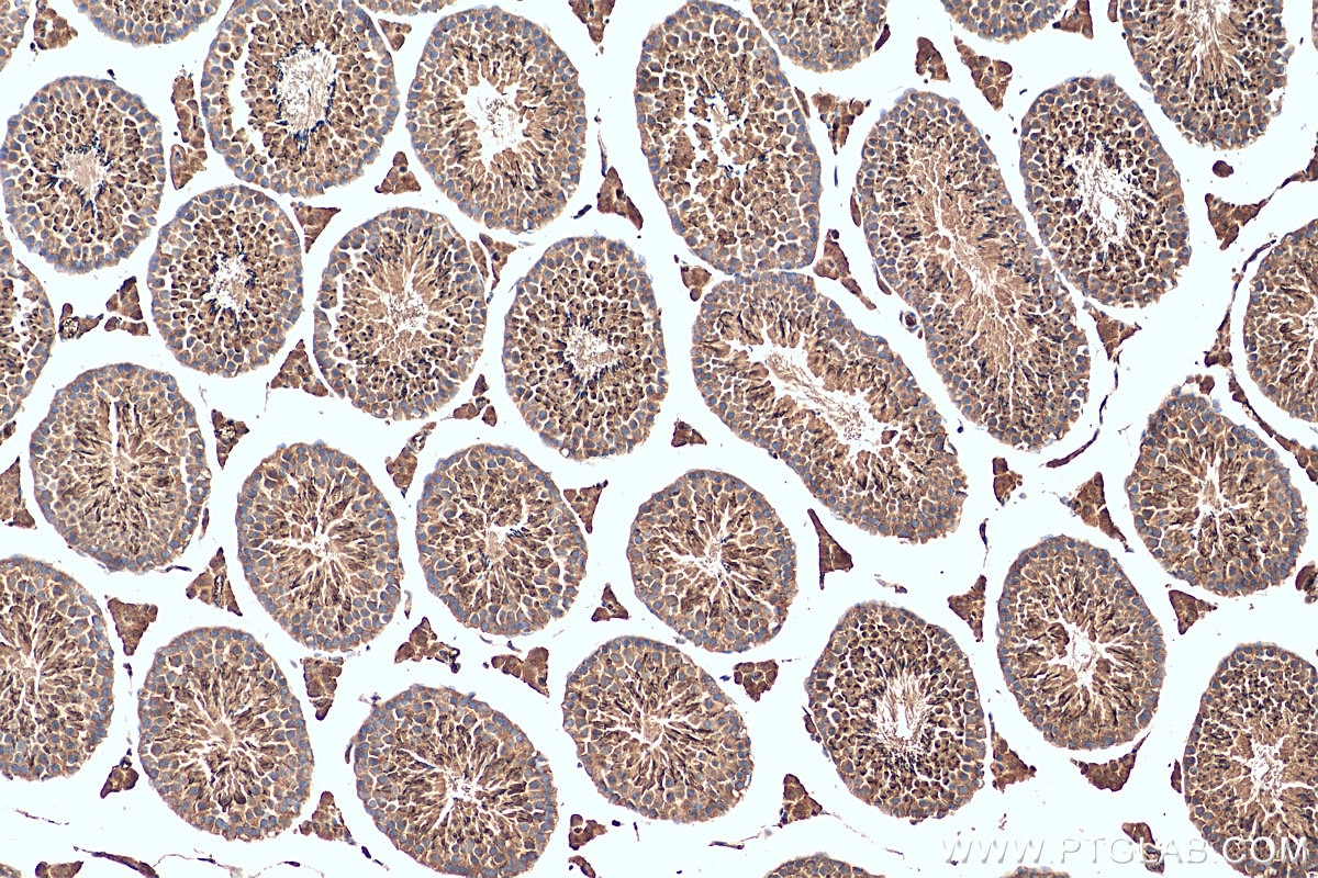 Immunohistochemistry (IHC) staining of mouse testis tissue using DHX57 Polyclonal antibody (24525-1-AP)