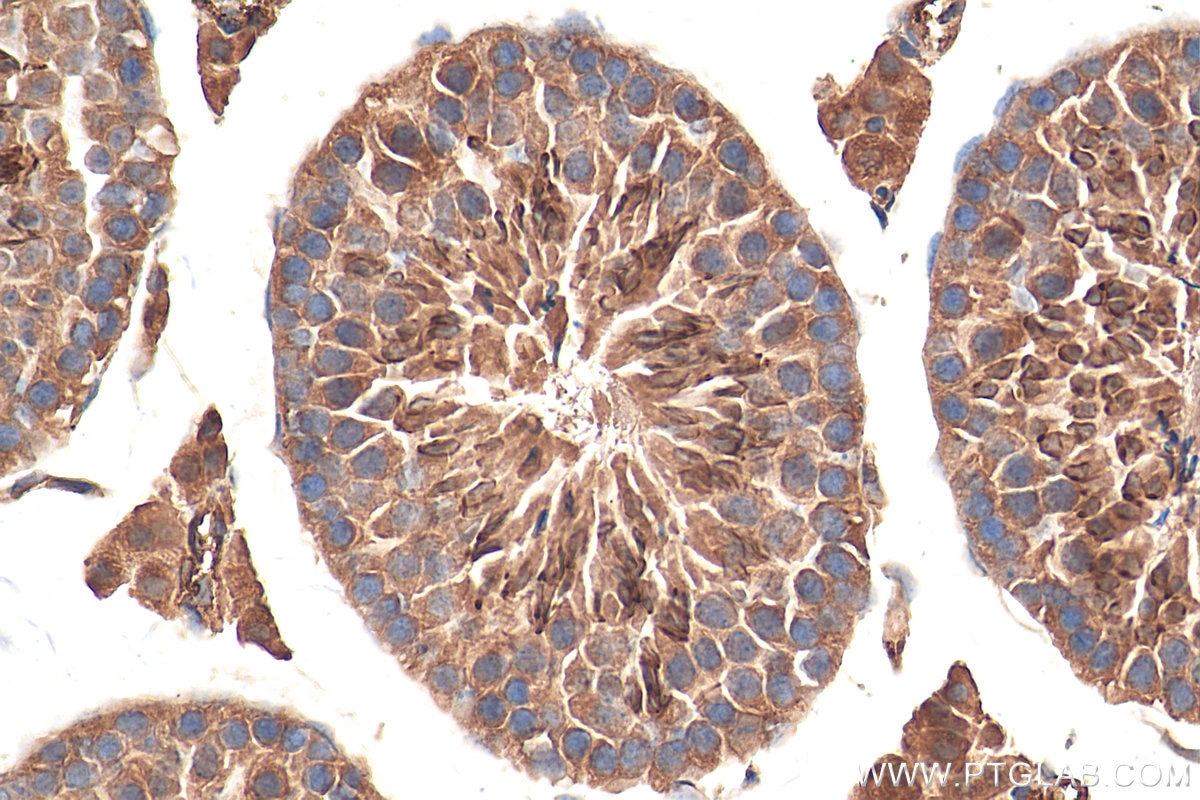 Immunohistochemistry (IHC) staining of mouse testis tissue using DHX57 Polyclonal antibody (24525-1-AP)