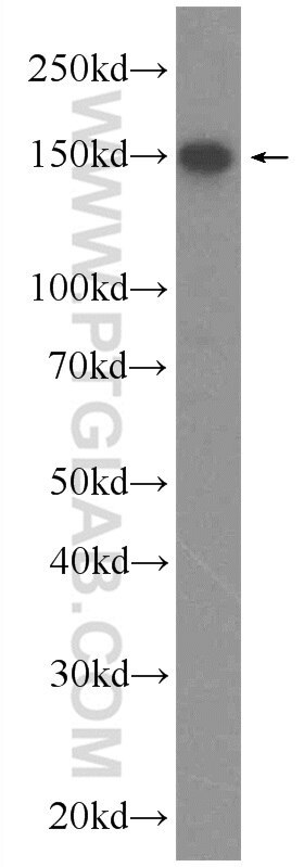 Western Blot (WB) analysis of HEK-293 cells using DHX57 Polyclonal antibody (24525-1-AP)