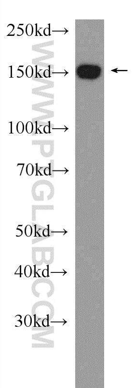 Western Blot (WB) analysis of HeLa cells using DHX57 Polyclonal antibody (24525-1-AP)