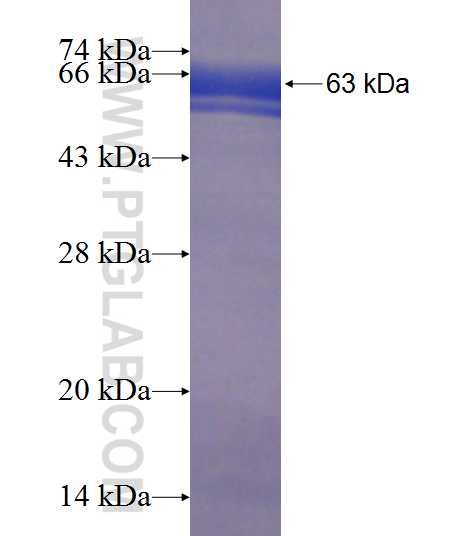 DHX57 fusion protein Ag21743 SDS-PAGE