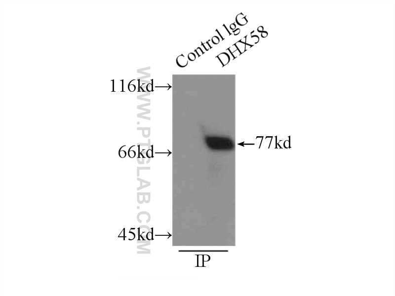 Immunoprecipitation (IP) experiment of mouse liver tissue using DHX58/LGP2 Polyclonal antibody (11355-1-AP)