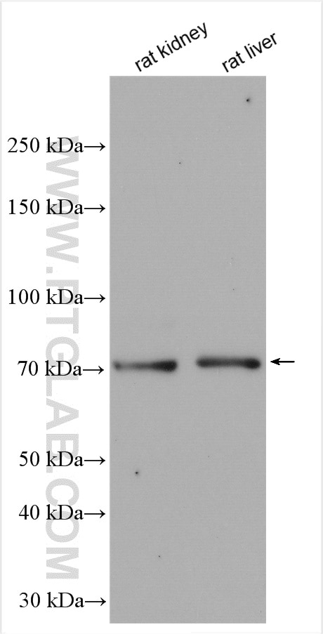 Western Blot (WB) analysis of various lysates using DHX58/LGP2 Polyclonal antibody (11355-1-AP)