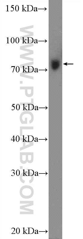 WB analysis of HEK-293 using 11355-1-AP