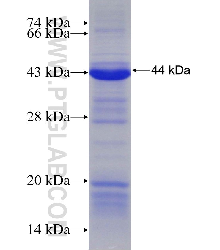DHX58 fusion protein Ag30382 SDS-PAGE