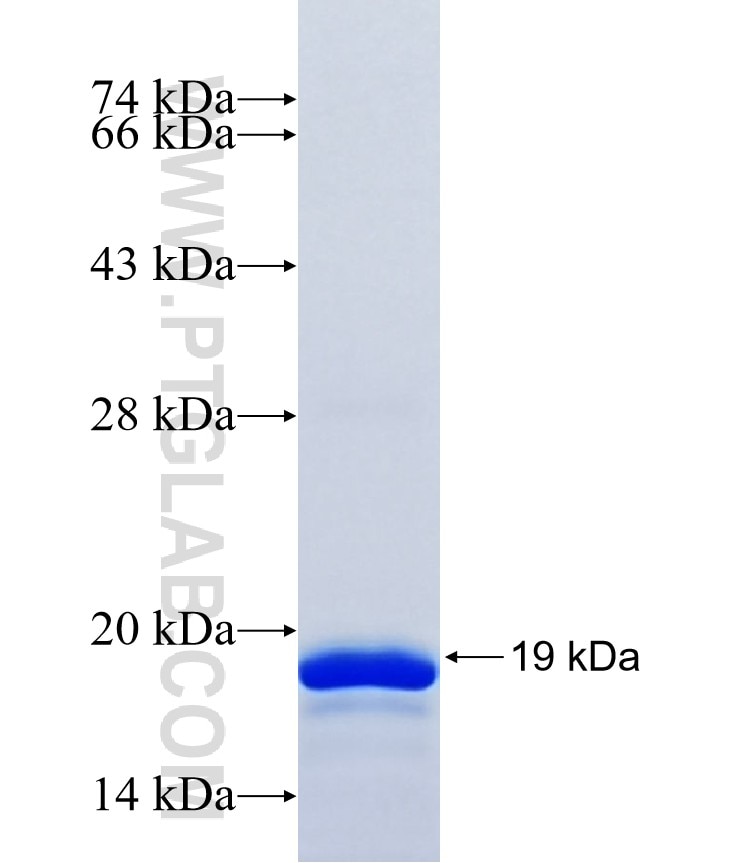 DHX8 fusion protein Ag41084 SDS-PAGE DHX8 fusion protein Ag41084 SDS-PAGE