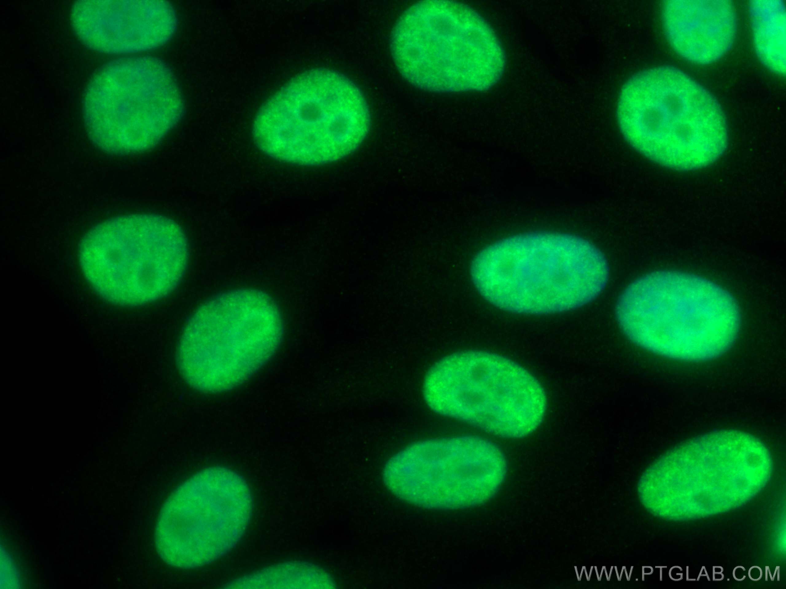 IF Staining of HepG2 using 17721-1-AP