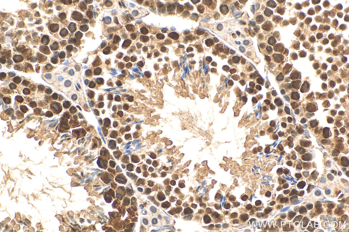 Immunohistochemistry (IHC) staining of mouse testis tissue using DHX9 Polyclonal antibody (17721-1-AP)