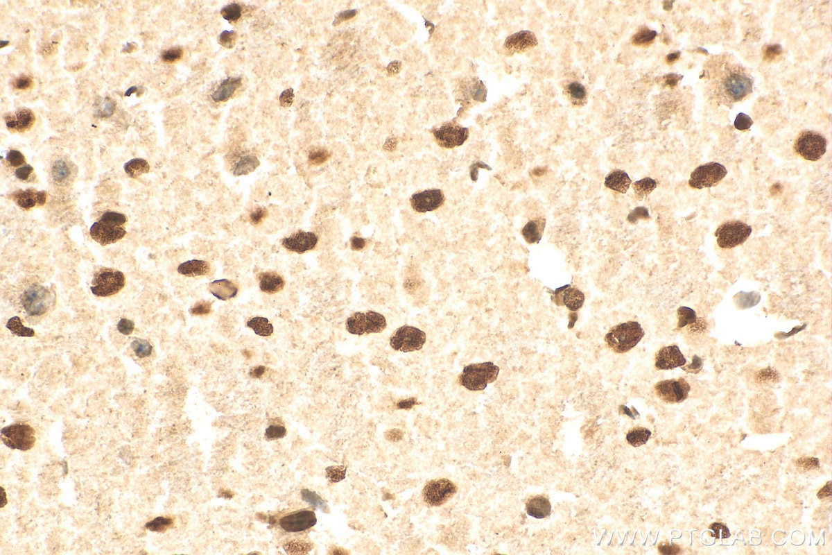 Immunohistochemistry (IHC) staining of mouse brain tissue using DHX9 Polyclonal antibody (17721-1-AP)