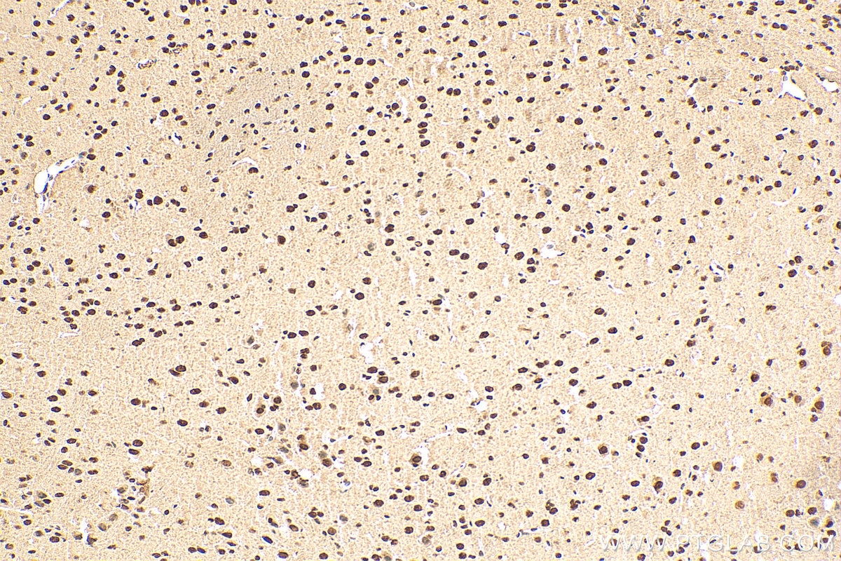 Immunohistochemistry (IHC) staining of mouse brain tissue using DHX9 Polyclonal antibody (17721-1-AP)