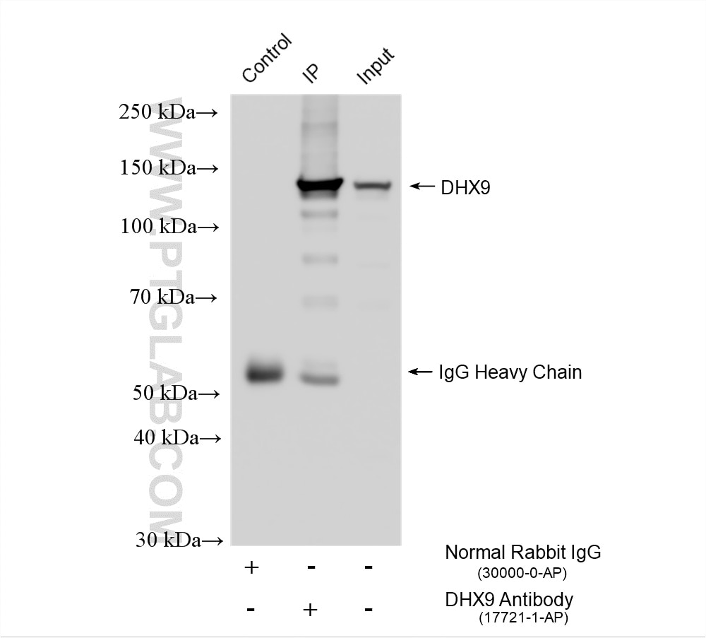 Immunoprecipitation (IP) experiment of HeLa cells using DHX9 Polyclonal antibody (17721-1-AP)