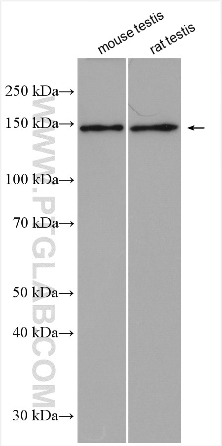 Western Blot (WB) analysis of various lysates using DHX9 Polyclonal antibody (17721-1-AP)