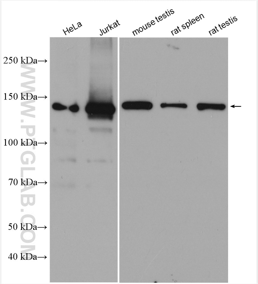 Western Blot (WB) analysis of various lysates using DHX9 Polyclonal antibody (17721-1-AP)