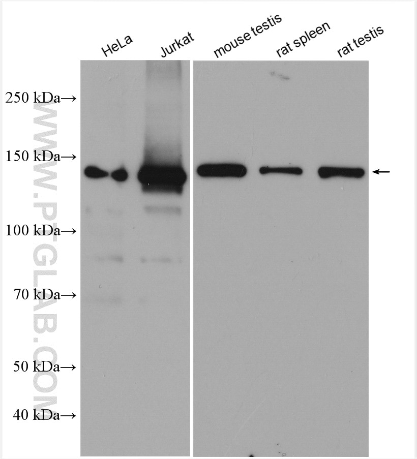 WB analysis using 17721-1-AP